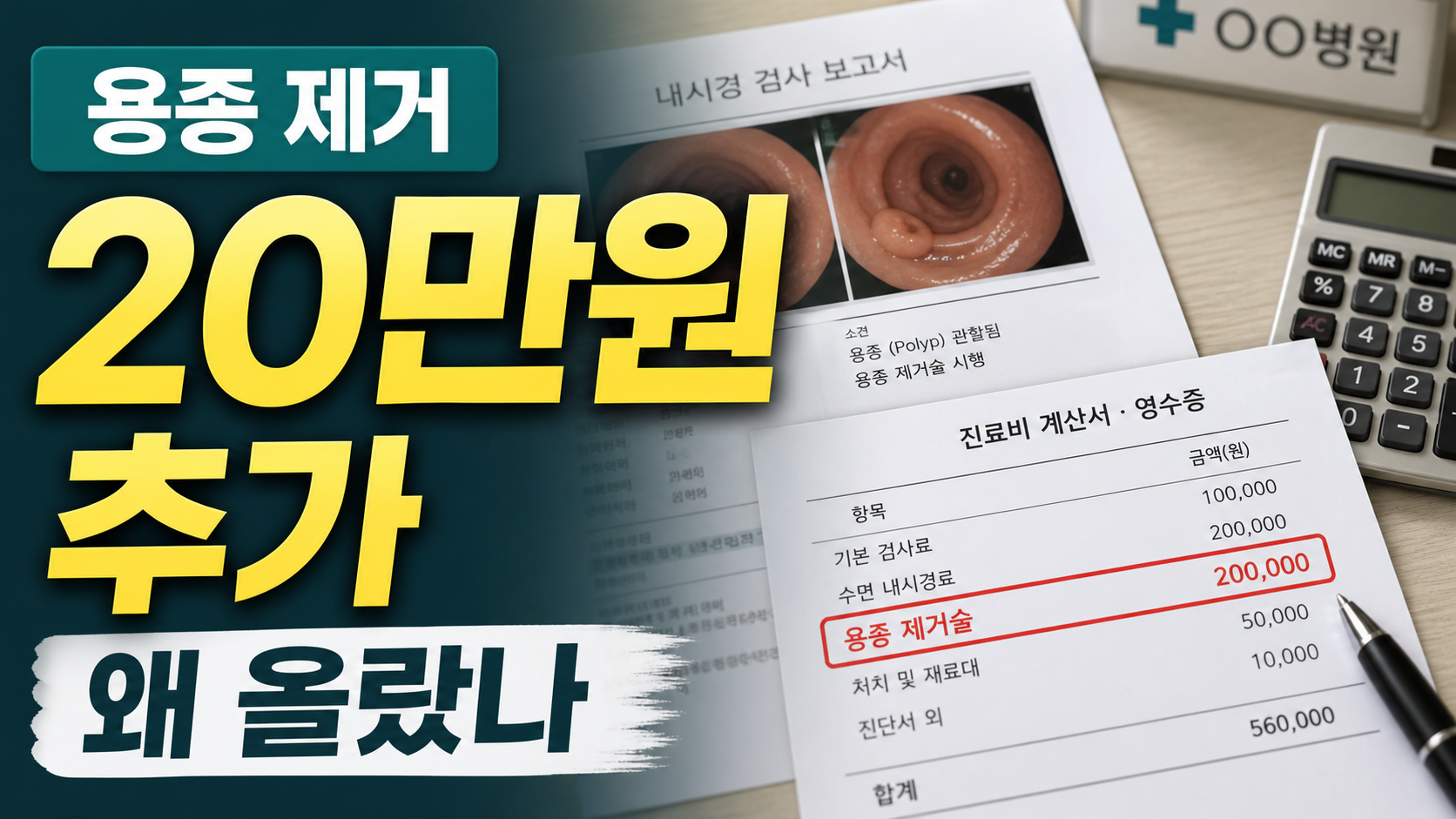 대장내시경 용종 제거 20만원, 검사비가 갑자기 오른 이유